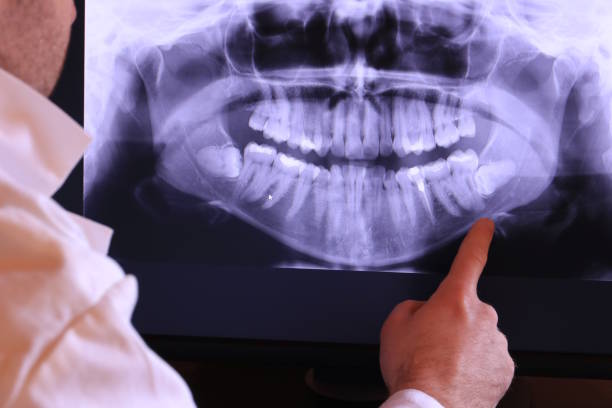 Best Emergency Dental Surgery in Blackstone, VA